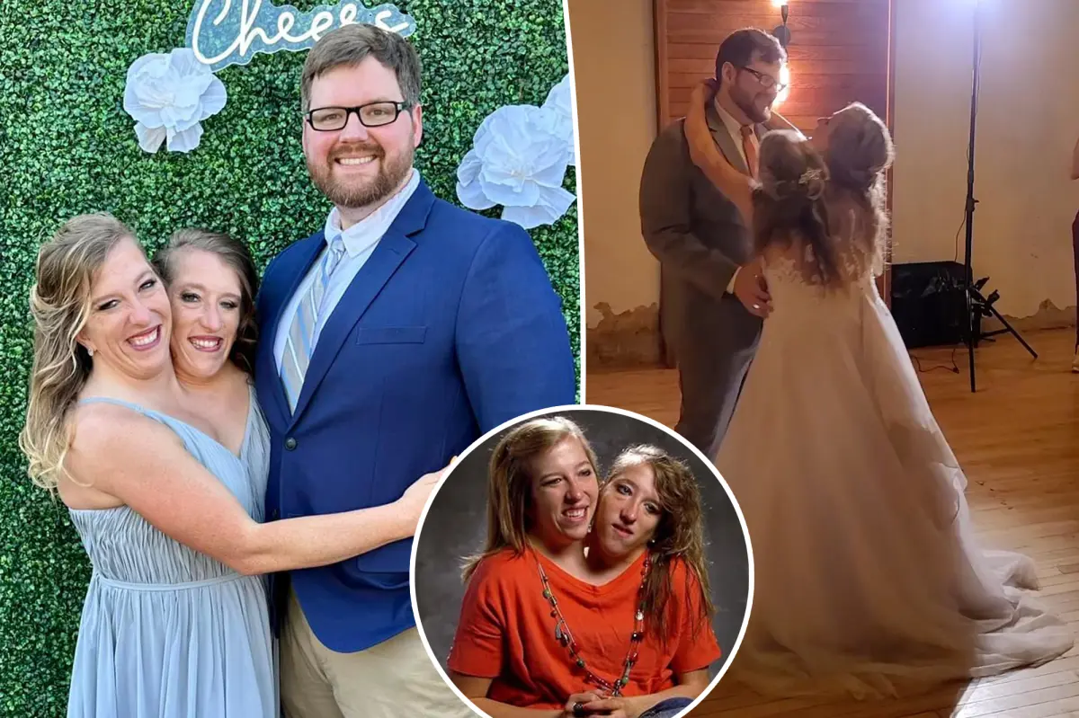 Conjoined Twins Abby Hensel is Finally Married