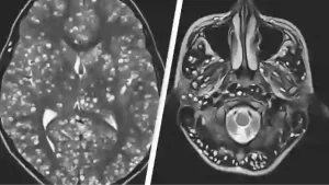 Terrifying study finds 30% of Americans could be infected with parasite that has horrific impact on brains.