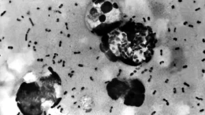 Arizona resident dies from plague, health officials say.