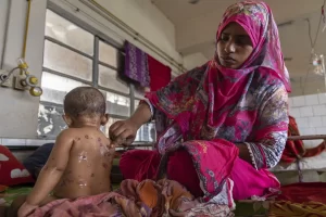 Bangladesh says suspected measles outbreak kills about 100 children.