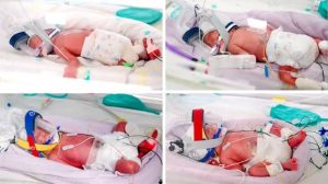 Rare identical quadruplets born in Australia.