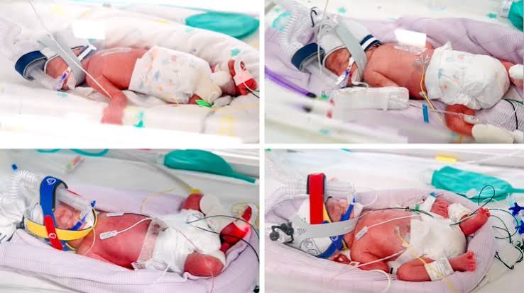 Rare identical quadruplets born in Australia.
