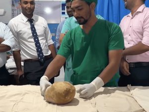 Doctors remove 3.1kg stone from man's bladder and claim record.
