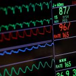 Adults with severe mental illness are 3.8 times more likely to die from cardiovascular disease before 75 and 2.3 times as likely from cancer, the study found.